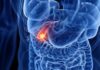 Targeted Therapy and Immunotherapy for Gallbladder Cancer -Dr. Pratik Patil